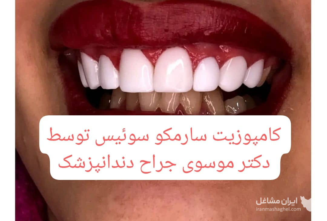 مطب تخصصی ایمپلنت و کامپوزیت دندان دکتر موسوی در تهرانپارس تهران
